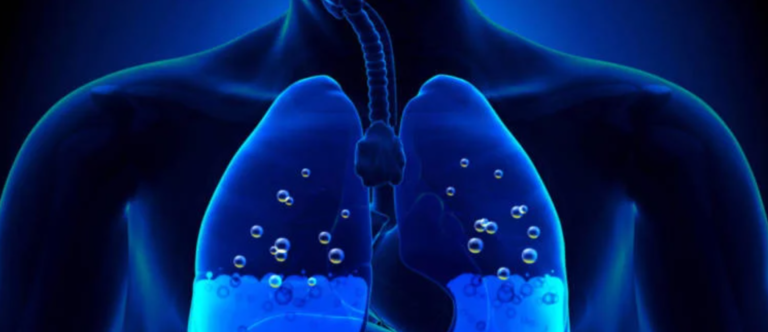 Immersion Pulmonaria Edema